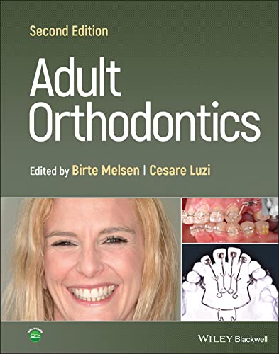 Adult Orthodontics von Wiley-Blackwell